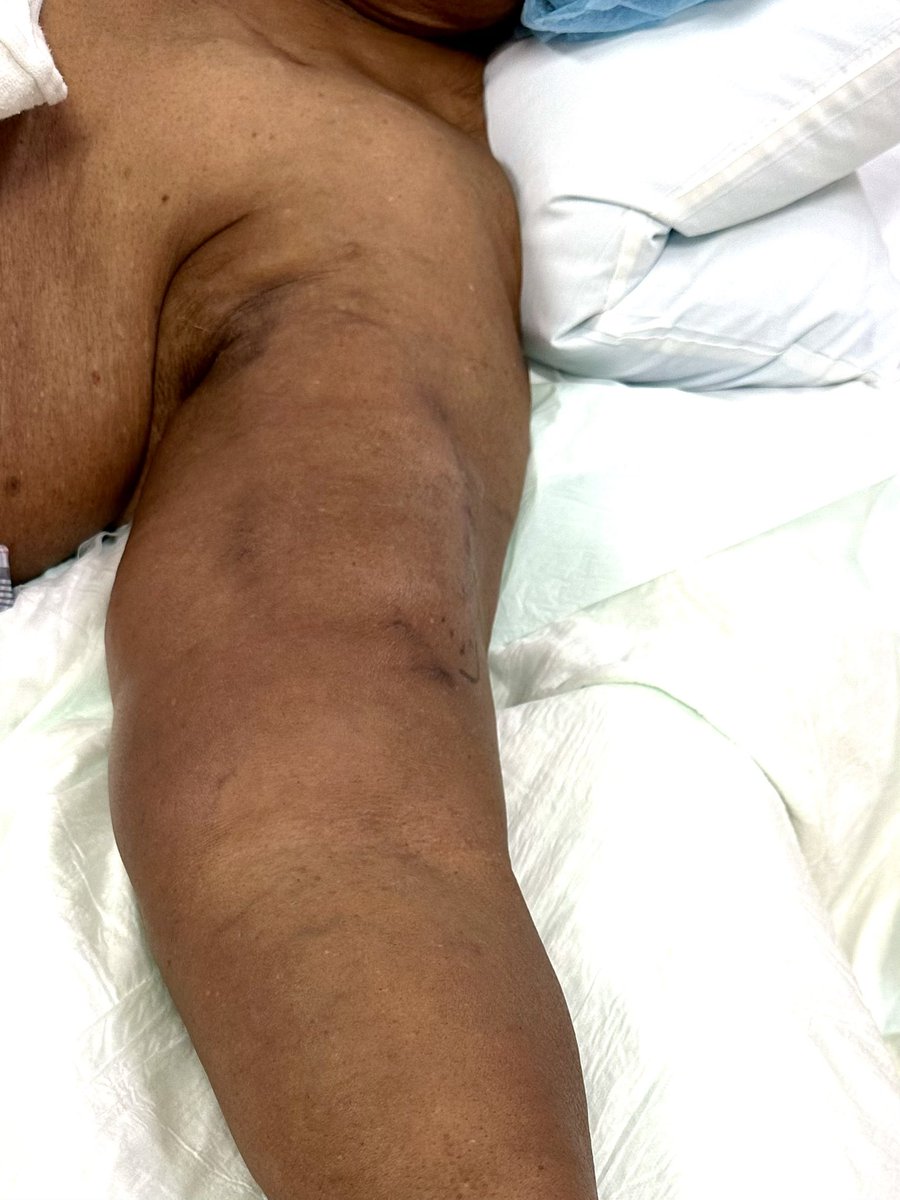 Neghae Mawla, MD, FASDIN tweet media