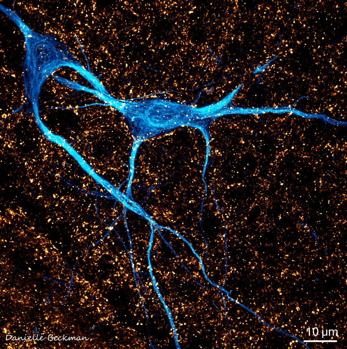 I saw two spaceships approaching each other. In the microscope😁🧠Airyscanning with <a href="/zeiss_micro/">ZEISS Microscopy</a>