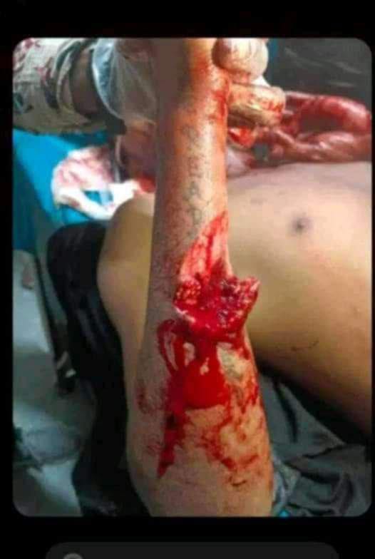 Sadikasharmin2's tweet image. #SaveBangladeshiStudents #DUUnderAttack #QuotaReformMovement 
#no_more_quotha 
#save_students #bangladesh_quotha_movement
#CNN #TheWashingtonPost
#TheNewYorkTimes #TheGuardian
#BBC #AlJazeera #TheWallStreetJournal
#CNBC #DhruvRathee #UnitedNations #NewYorkTimesOpinion
#ABCNews