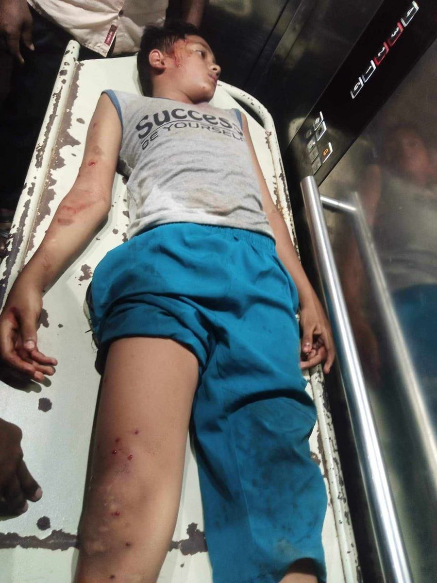 Sadikasharmin2's tweet image. #SaveBangladeshiStudents #DUUnderAttack #QuotaReformMovement 
#no_more_quotha 
#save_students #bangladesh_quotha_movement
#CNN #TheWashingtonPost
#TheNewYorkTimes #TheGuardian
#BBC #AlJazeera #TheWallStreetJournal
#CNBC #DhruvRathee #UnitedNations #NewYorkTimesOpinion
#ABCNews