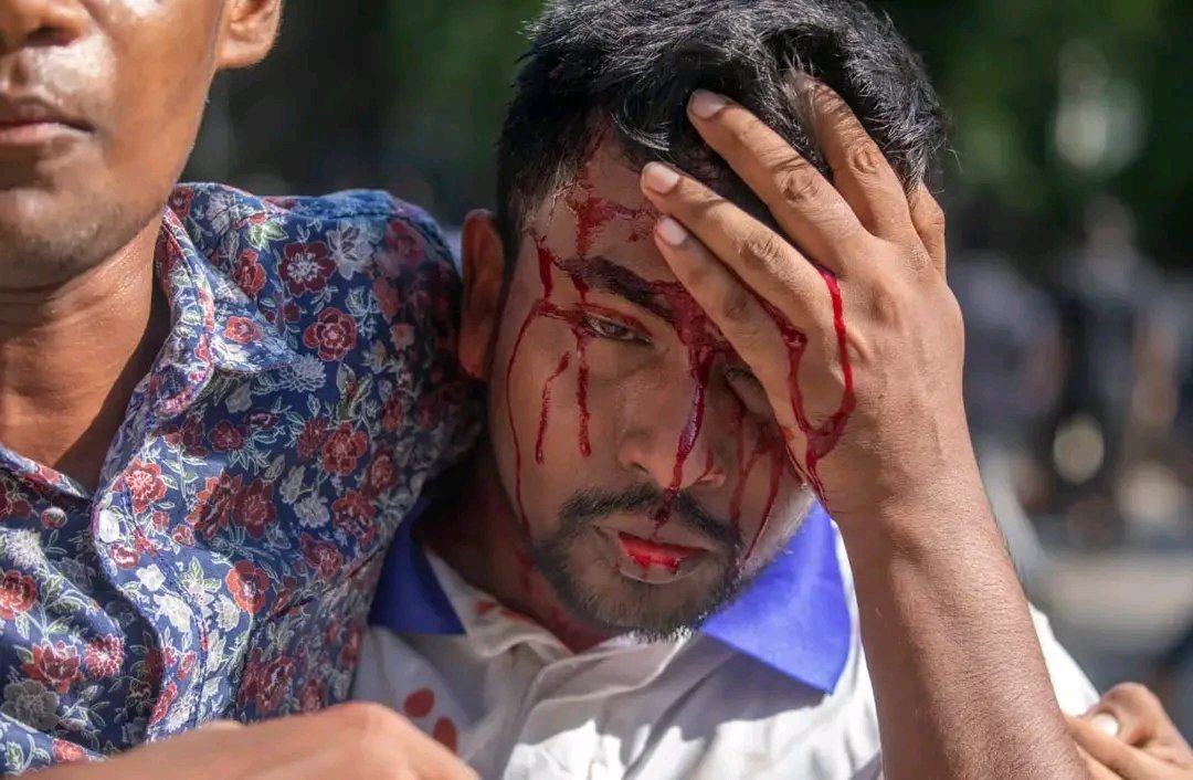 Farjana2640's tweet photo. Save us please save Bangladeshi students 

#SaveBangladeshiStudents #SaveTheStudents #StudentsUnderAttack #quotareformmovement2024 #Bangladesh
#Save_Bangladeshi_students https://t.co/VZPIeS1mjJ