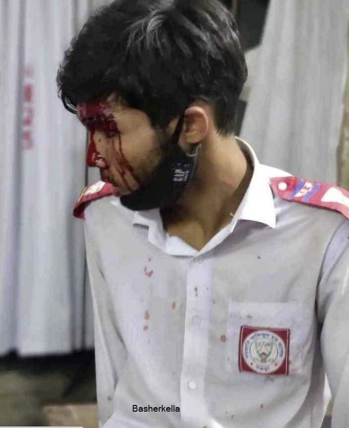 Farjana2640's tweet photo. Save us please save Bangladeshi students 

#SaveBangladeshiStudents #SaveTheStudents #StudentsUnderAttack #quotareformmovement2024 #Bangladesh
#Save_Bangladeshi_students https://t.co/VZPIeS1mjJ