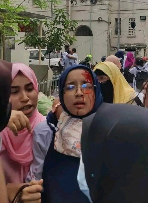 Farjana2640's tweet photo. See how my sisters and brothers are bleeding 😭😭 

#SaveBangladeshiStudents #SaveTheStudents #StudentsUnderAttack #quotareformmovement2024 #Bangladesh
#Save_Bangladeshi_students https://t.co/zQIzhkLsTS