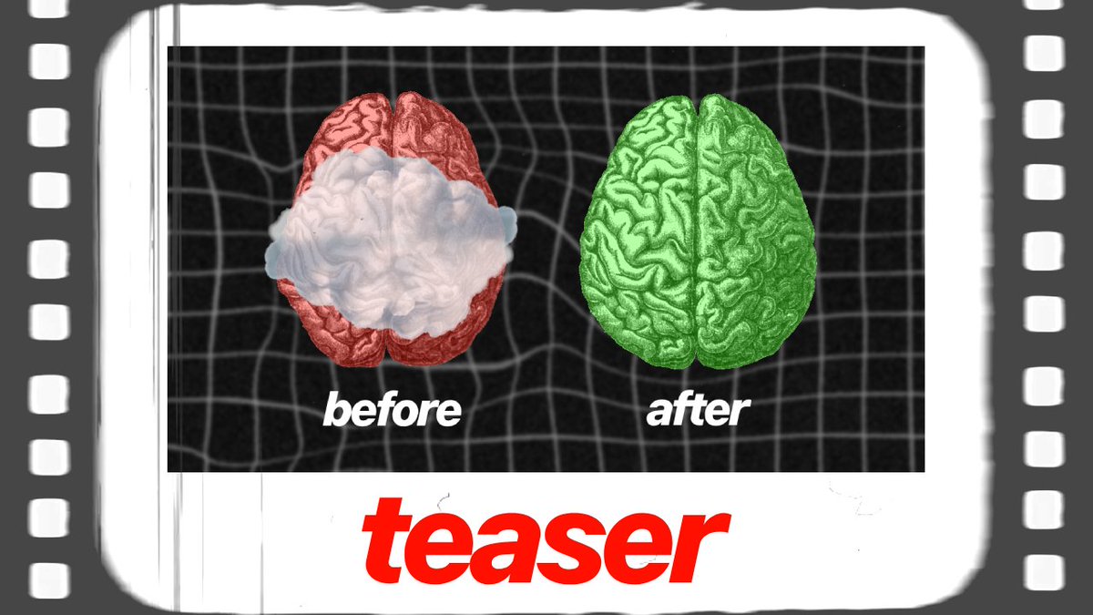 Cheetah_Sprts's tweet image. &quot;Breaking the Fog&quot;  - The #Science of calming down your #Brain coming on Saturday 20th July 2024.  

#improvefocus #sportsscience #focus #improveconcentration #selfdevelopment #selfimprovement #aliabdaal #improvefocus #sportsstudy  #neuroscience #neurology #personalgrowth
