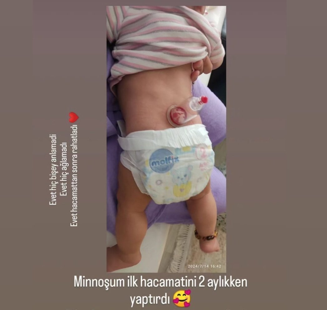 DrOzanUnlu's tweet photo. Bu ne?!?! Daha fazla olmaz dedikçe oluyor. Bunu yapan da yaptıran da suç işliyor. Birileri artık buna dur demeyecek mi? Nereye gidiyoruz? https://t.co/w4juLMLxRZ