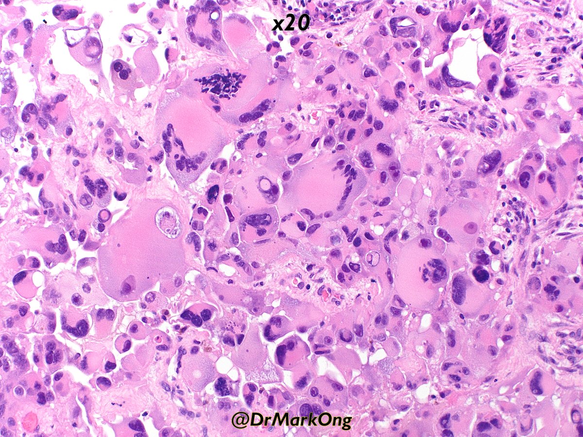 Mark Ong tweet media