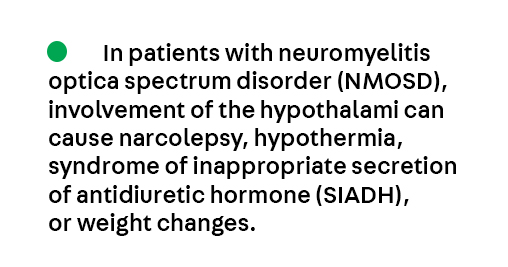 Continuum: Lifelong Learning in Neurology (@continuumaan) on Twitter photo Key Point 3 from the article Emergent Management of Central Nervous System Demyelinating Disorders by Dr. Barry M. Czeisler (<a href="/BarryCzeislerMD/">Barry M. Czeisler, MD, MS, MHPE, FAAN</a>) from the June #Neurocritical Care issue, which is available to subscribers at bit.ly/4cHyJej. #Neurology #NeuroTwitter #MedEd Key Point 3 from the article Emergent Management of Central Nervous System Demyelinating Disorders by Dr. Barry M. Czeisler (<a href="/BarryCzeislerMD/">Barry M. Czeisler, MD, MS, MHPE, FAAN</a>) from the June #Neurocritical Care issue, which is available to subscribers at bit.ly/4cHyJej. #Neurology #NeuroTwitter #MedEd
