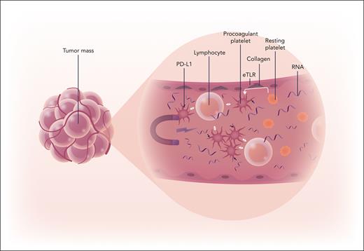 In cancer, not all platelets are created equal
ow.ly/XqvT50SzQ7N #plateletsandthrombopoiesis