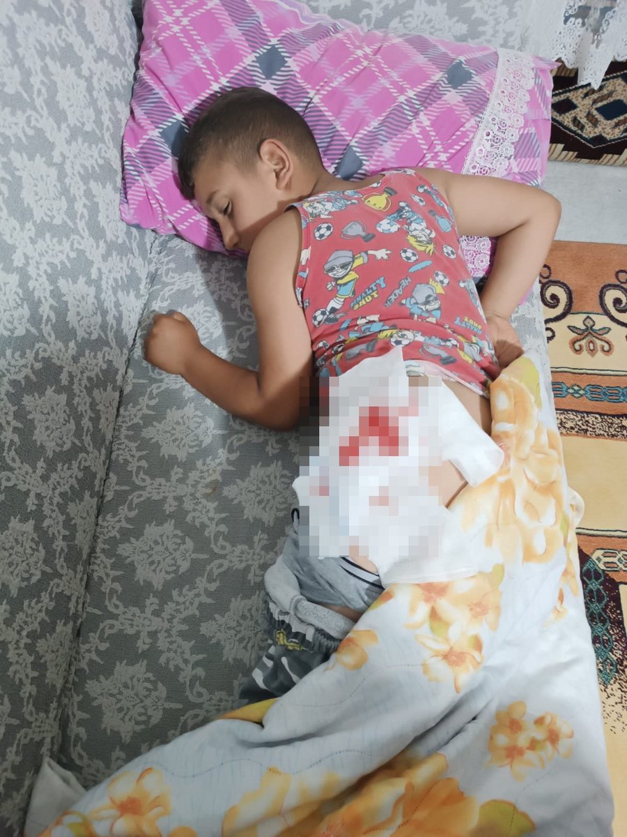 Bingöl Karliova'da dışarıda oynadıktan sonra evine dönen 8 yaşındaki çocuk, başıboş sokak köpeklerinin saldırısına uğradı.

Çocuklarımızı korumak için
#MilletYasayaEvetDiyor
#yasayaevet
