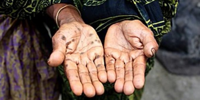 American College of Medical Toxicology tweet media