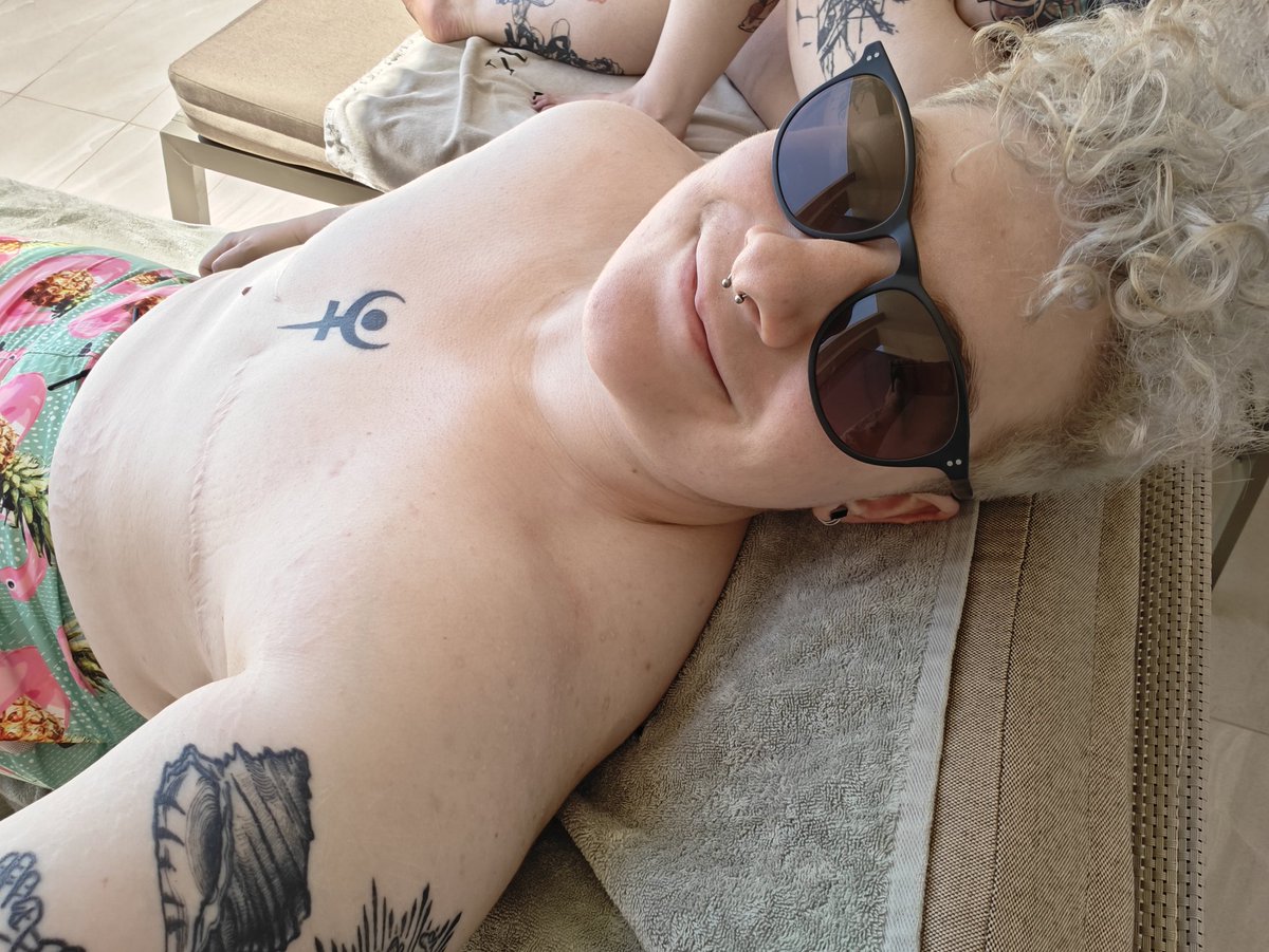 CaptainWhelmed's tweet photo. I'm just a few days late but bloody hell, I'm officially two years post top surgery, how mad is that ??

Left: July 2022 (12 days post op) Right: June 2024 (1 year 11 months) https://t.co/bFxJF9EJbK