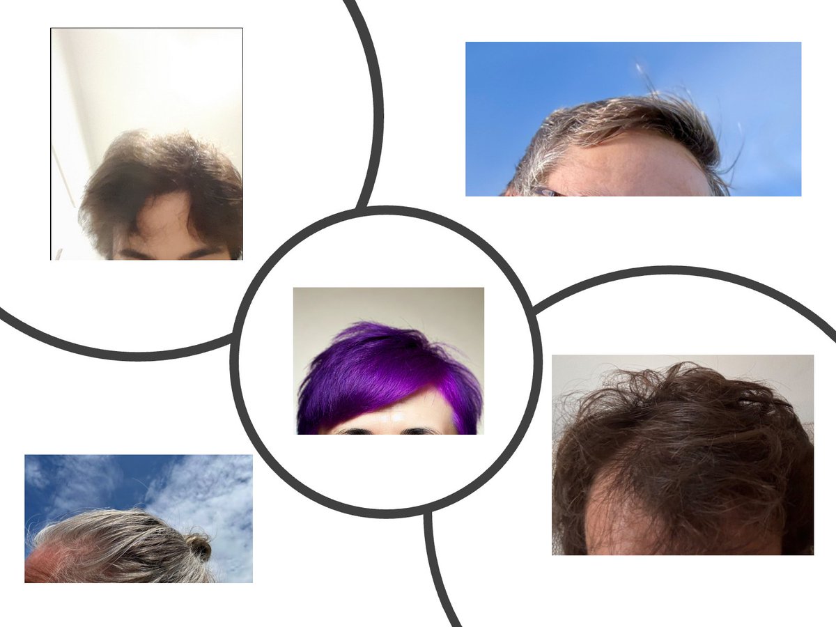 specialkoinos's tweet image. AM I THE ONLY ONE PUSHING FOR HAIR? 💇
C'MON #KOMMUNITY !!!! 
WE WANT MORE HAIRDOXXING !!!! 🥰
#hairdoxxing for $bald at #koinos with native $koin
YOURS #Ӄ