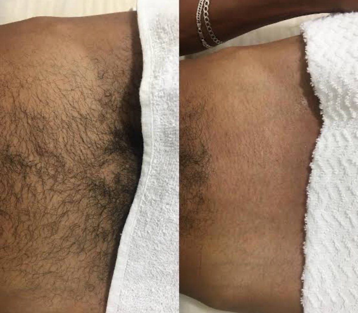 vanio_cesar's tweet photo. Liso ou com pelo ???
Venha fazer sua manutenção comigo
Cuide sempre bem do seu rapaz https://t.co/cGmg7U2Xjb