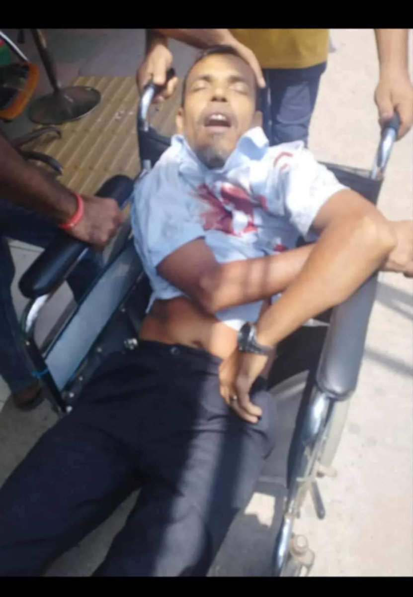 raiisdeadd's tweet image. ‼️BRAC University students getting seriously injured including their AMBULENCE DRIVER‼️
Police BGB are inhumanly torturing students for no reason
#Bangladesh 
#BDunderattack