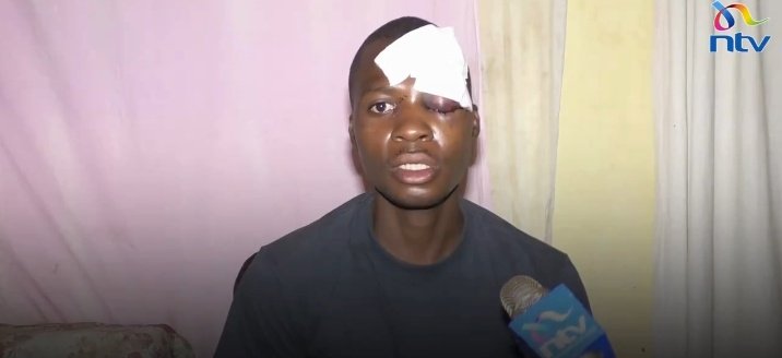 mohamedosmanMsa's tweet photo. WATCH SAD MOMENTS AS PROTESTER WHO WAS SHOT AND SURVIVED SAYS HE THOUGHT HE HAD DIED. KINDLY RETWEET AND SHARE WIDELY UNTIL HE GETS JUSTICE AND COPS RESPONSIBLE ARRESTED WATCH 👇 #OccupyUhuruPark #OccupyUhuruPark"Nairobi CBD"KairoKasmuelJKIA https://t.co/Gq5jTBhX5M
