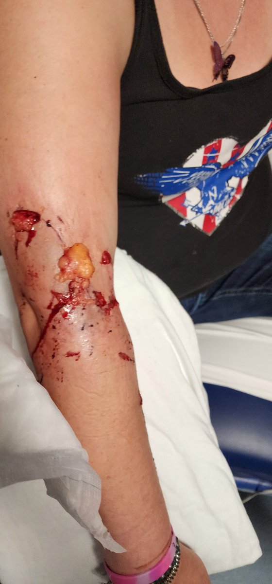 rcwrapguy's tweet photo. @MecklenburgEMS how is this a non-emergency medic call??? Called 911 and was told by you this is non emergency and would send a medic when resources are available, no eta thank you @CharlotteFD  station 10 for taking care of my wife. https://t.co/nOsXR3dm5x