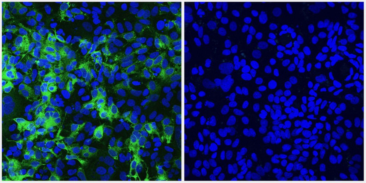 CNB_CSIC's tweet photo. Identifican nuevos marcadores para el diagnóstico precoz de patologías hepáticas graves tras la curación de hepatitis C
Más info: https://t.co/1J8l5SXNlc
Artículo científico en Journal of Medical Virology: https://t.co/mqij73fXYK https://t.co/tgrsr4s09O
