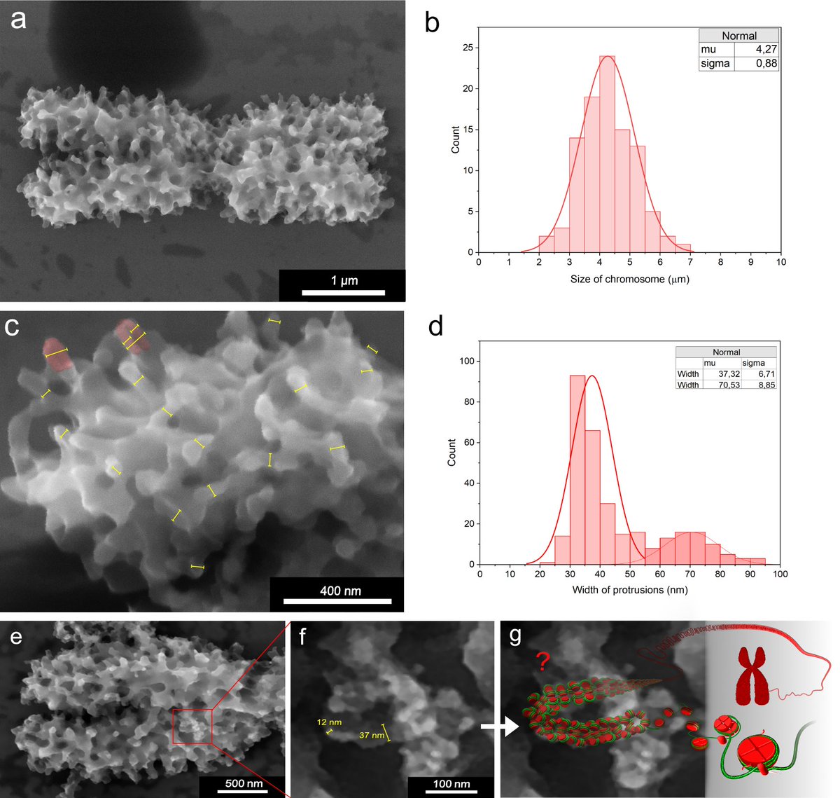 CzechAcademy's tweet photo. Revolutionary method pioneered by Czech scientists reveals chromosome structure

🔹 Czech scientists are the first in the world to have imaged an entire chromosome in its native state. 

🔹 Thanks to the new revolutionary Advanced Environmental Scanning Electron Microscopy (A–ESEM) imaging method, researchers from our Institute of Scientific Instruments in collaboration with @IBOTCZ achieved what experts from leading laboratories all over the world have been striving for. 

🔹 Revealing the structure of the chromosome surface, consisting of protrusions and chromatin fibers spatially organized in loops, has potential implications for fields like medicine and agriculture.

Study ➡️ https://t.co/x6BraHWtUV

Press release ➡️ https://t.co/nHZD50KQsK