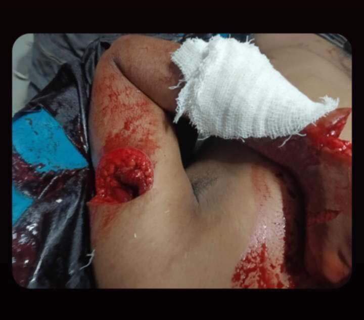 rashad_2161392's tweet photo. A student was left in this condition as the ruling party unleashed their Student Wing, Police, Border Guard &amp; SWAT on students protesting at the University of Dhaka. 

#AlleyesonBangladesh 
#SaveBangladeshiStudents https://t.co/Vtmr1OCYlc