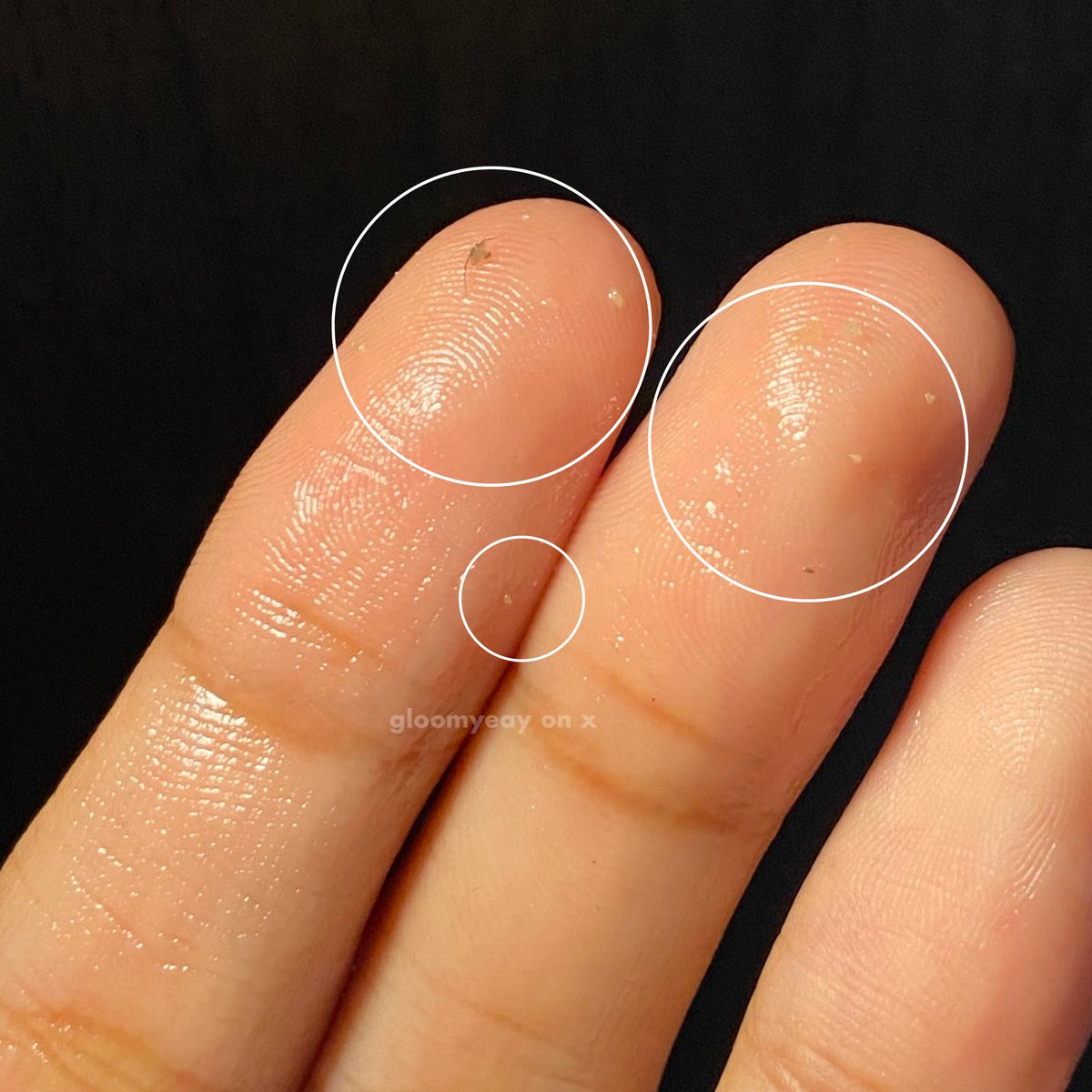 gloomyeay's tweet photo. PLEASE STOP paksa ekstraksi komedo dan sebaceous filaments pake alat pencabut komedo besi itu😭‼️

nih coba terapin teknik oil gritting dijamin pd rontok, caranya gampang dan gak bikin iritasi.

aman buat yg punya kulit kering/sensitive https://t.co/1R3HAqNkM0