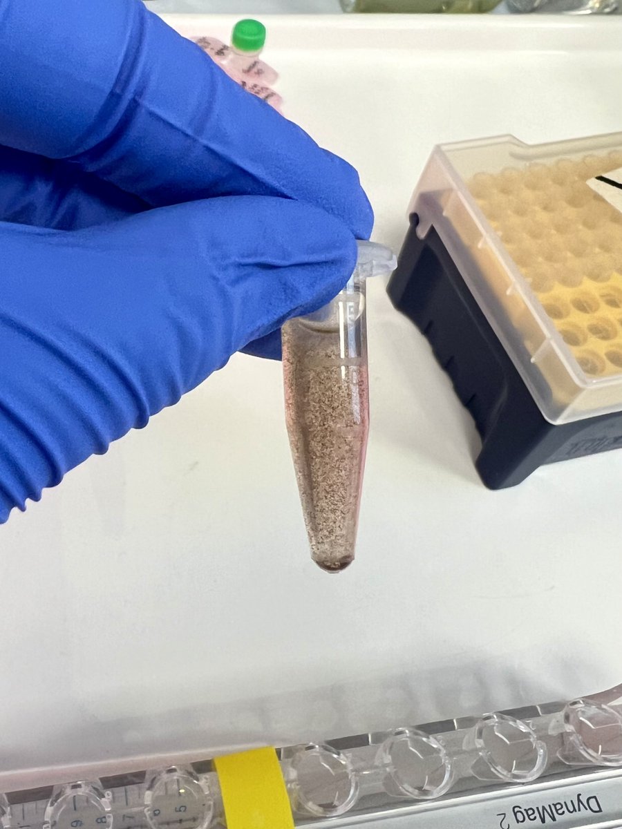 LJRussell_Lab's tweet photo. If our genetic code is the same in every cell, how do we have so many different cell types? Histone modifications tag our genetic code to open or close it for reading. Phoebe studies these proteins in a rare leukaemia, seeking open regions that might make good treatment targets. https://t.co/rmuFy6klln