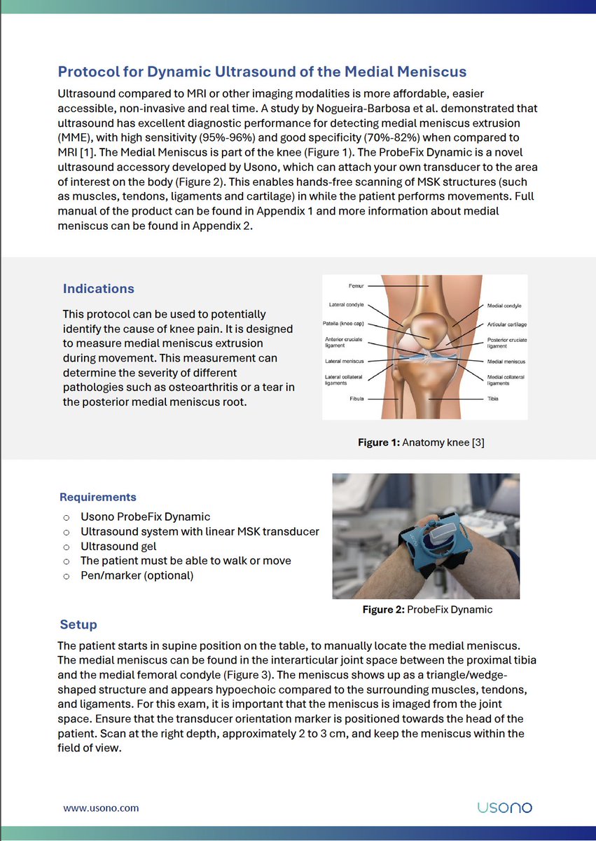 Two students from <a href="/Fontys/">Fontys</a> recently graduated on protocols for functional ultrasound using #ProbeFixDynamic &amp; <a href="/vscan/">GE HealthCare Vscan Family</a>. Currently finetuning the docs! Are you interested in a free early preview version? Leave your email address in the comments 📨!