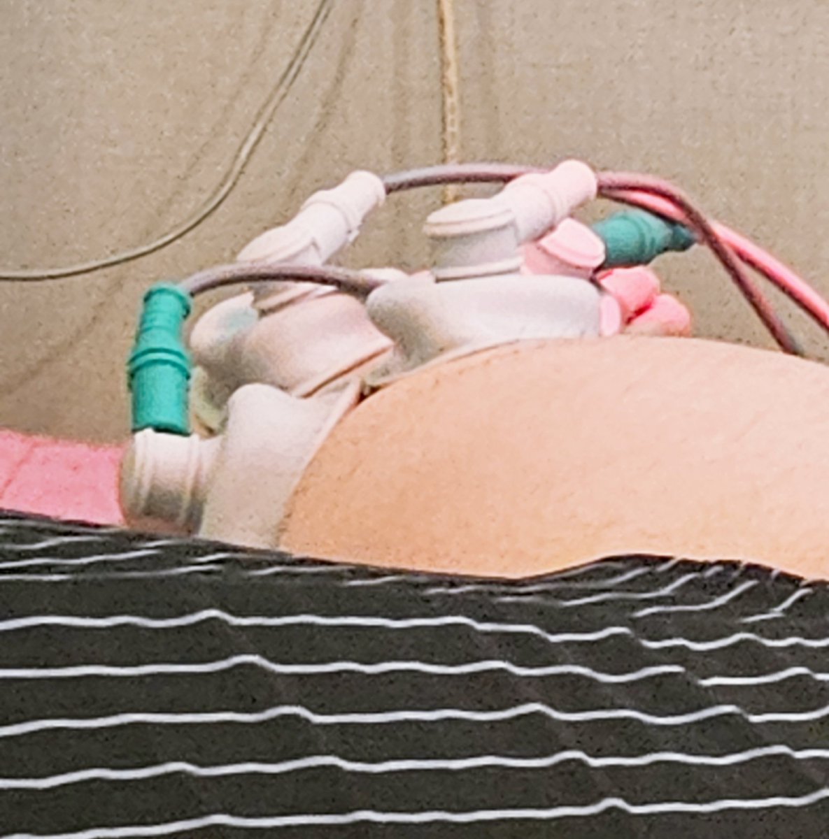 아 진짜 ㅈ같다...ㅋㅋ하필 왜?
맨탈 후두둑이다...ㅋㅋㅋㅋㅋㅋㅋ
발목삐끗해서 치료 받으러 한의원옴..ㅋㅋ
왜 하필 행사가기 전에 이런일이...ㅋㅋㅋㅋㅋㅋㅋㅋㅋㅋ