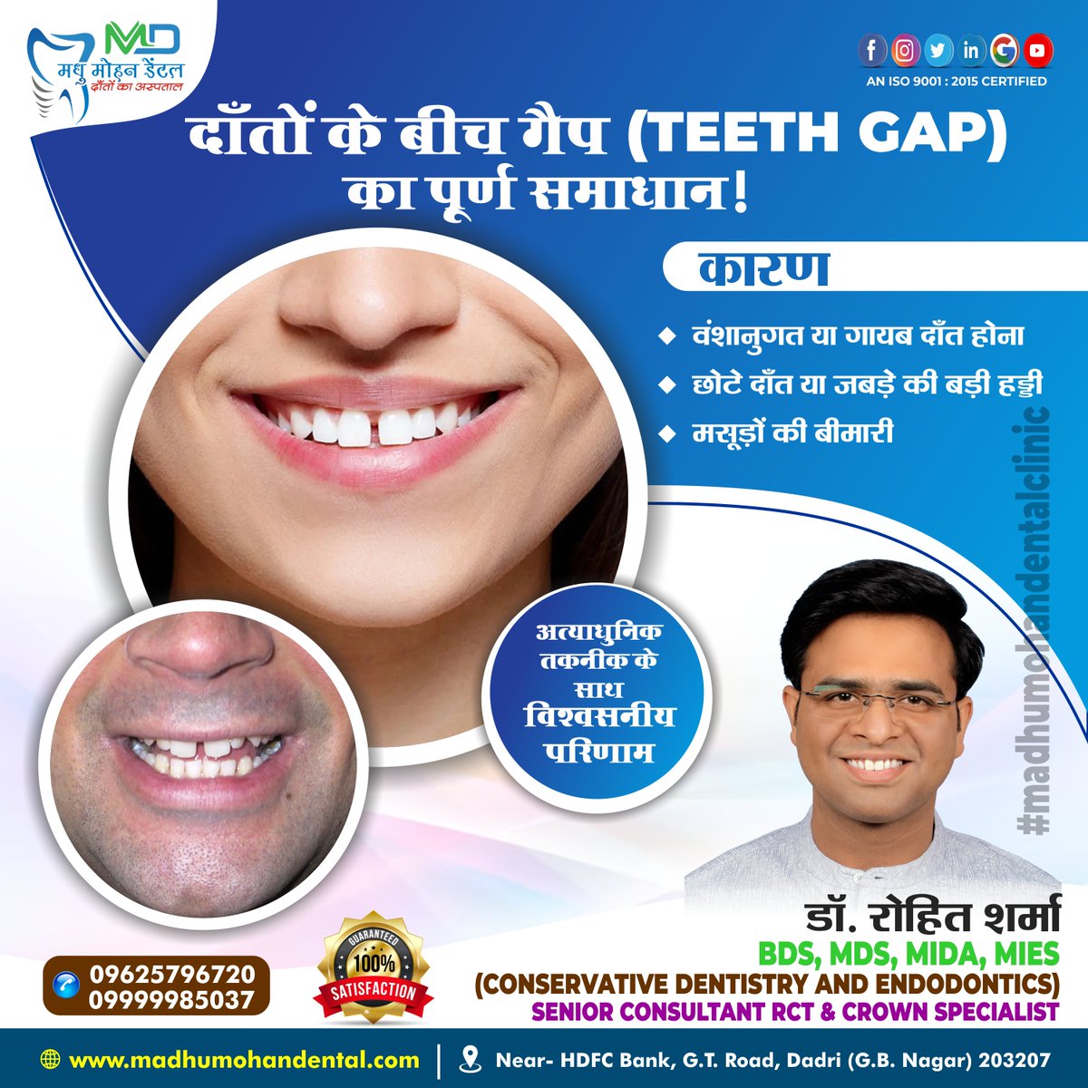 madhu_m_dental's tweet photo. Close the gap and perfect your smile! Our expert dental treatments give you the confidence to shine. Say goodbye to gaps with our specialized care.
#madhumohandental #PerfectSmile #CloseTheGap #ExpertDentistry #ConfidentYou #OralHealth #brighterteeth #GumCare #greaternoida https://t.co/nv7N83N0xG