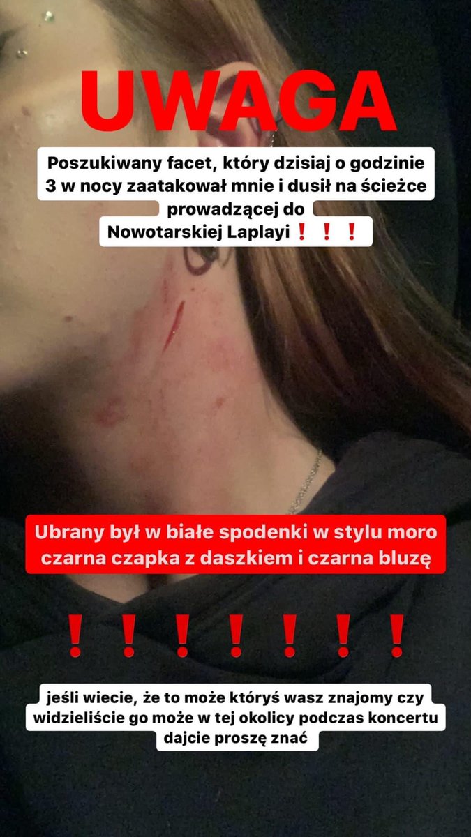 AzideHunter's tweet photo. Uważajcie na siebie, dziewczyna tylko wracała z pracy do domu kiedy ktoś ją zaatakował. 

W komentarzu opis zdarzenia 

I pomóżcie dziewczynie jak macie fb żeby to nagłośnić https://t.co/N8Oyw5oD4e