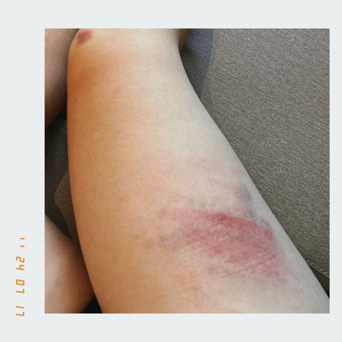 愿可做你，
脚下那堆烂泥，
来守护你，
我未理身上那污秽。 https://t.co/MrVWok4D85