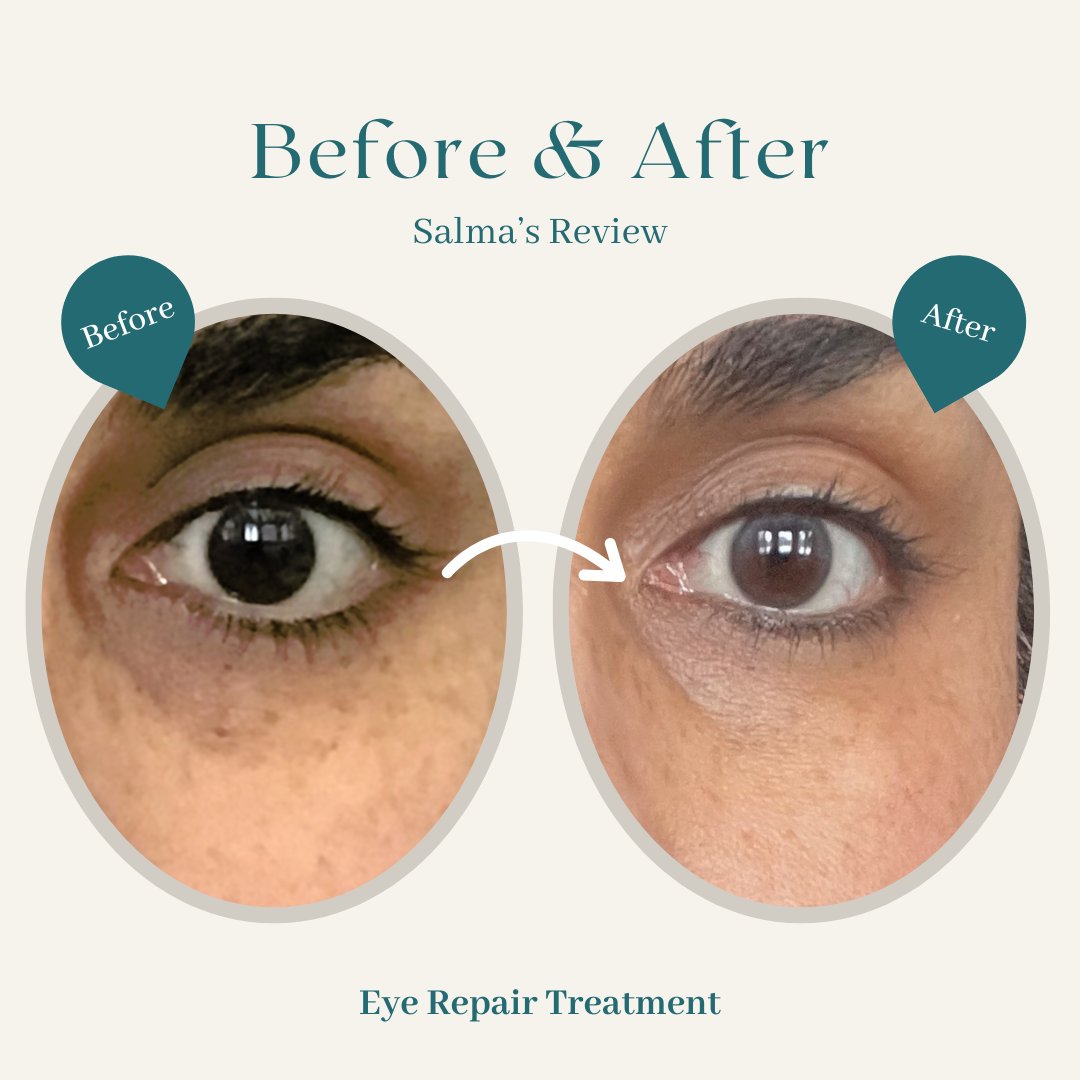 ⭐️⭐️⭐️⭐️⭐️
"Great Eye Cream"

"I love this product, it is lightweight yet very moisturizing and fragrance-free. I have been using it for over a year and I feel it has brightened my under-eye area."

Thank you for your kind review Salma! 💙

#eyecream #beforeafter #realresults