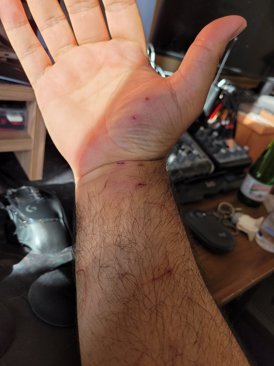 Ölmeme gerek yok efenim. O ihtimal her zaman var. 🤭