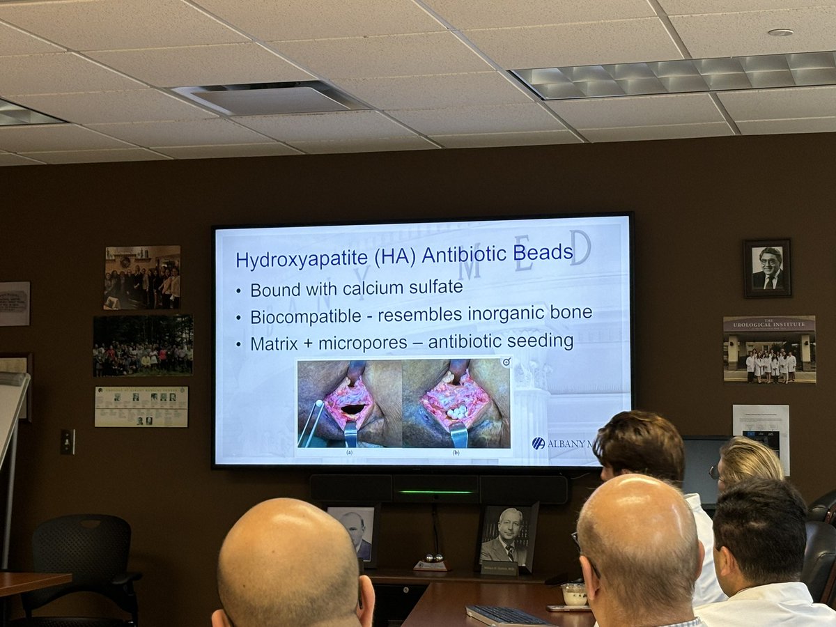 RealSchammgod's tweet photo. S/o to @nprok17 for a great talk this morning about the use of hydroxyapatite beads in the setting of pubectomy for pubic osteomyelitis! These surgeries are extremely morbid and this tech could help patients recover better! #UroSoMe #GURecon #AMCUrology https://t.co/FlUj4lDi62