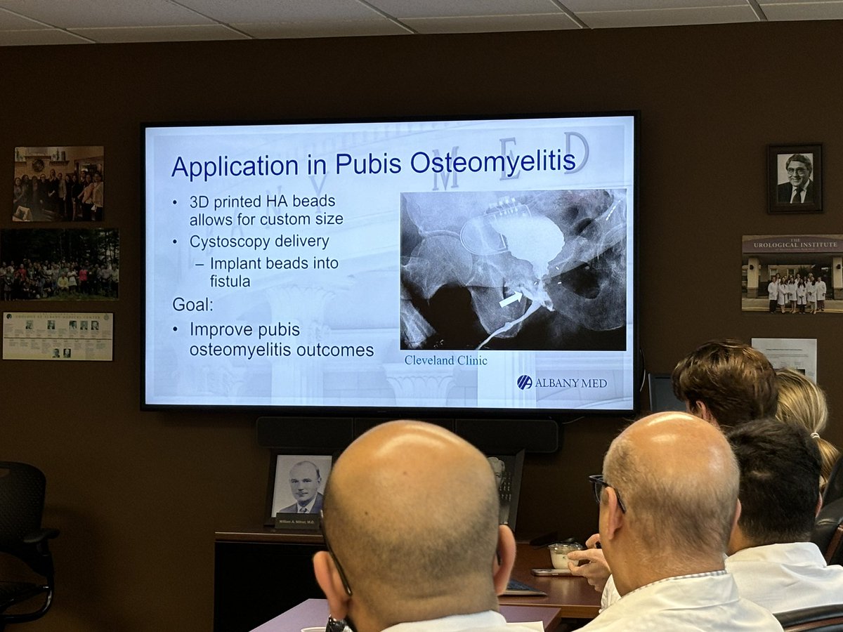 RealSchammgod's tweet photo. S/o to @nprok17 for a great talk this morning about the use of hydroxyapatite beads in the setting of pubectomy for pubic osteomyelitis! These surgeries are extremely morbid and this tech could help patients recover better! #UroSoMe #GURecon #AMCUrology https://t.co/FlUj4lDi62