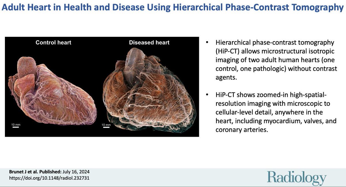Amazing new CT-based cardiac imaging technique pubs.rsna.org/doi/10.1148/ra… #YesCCT