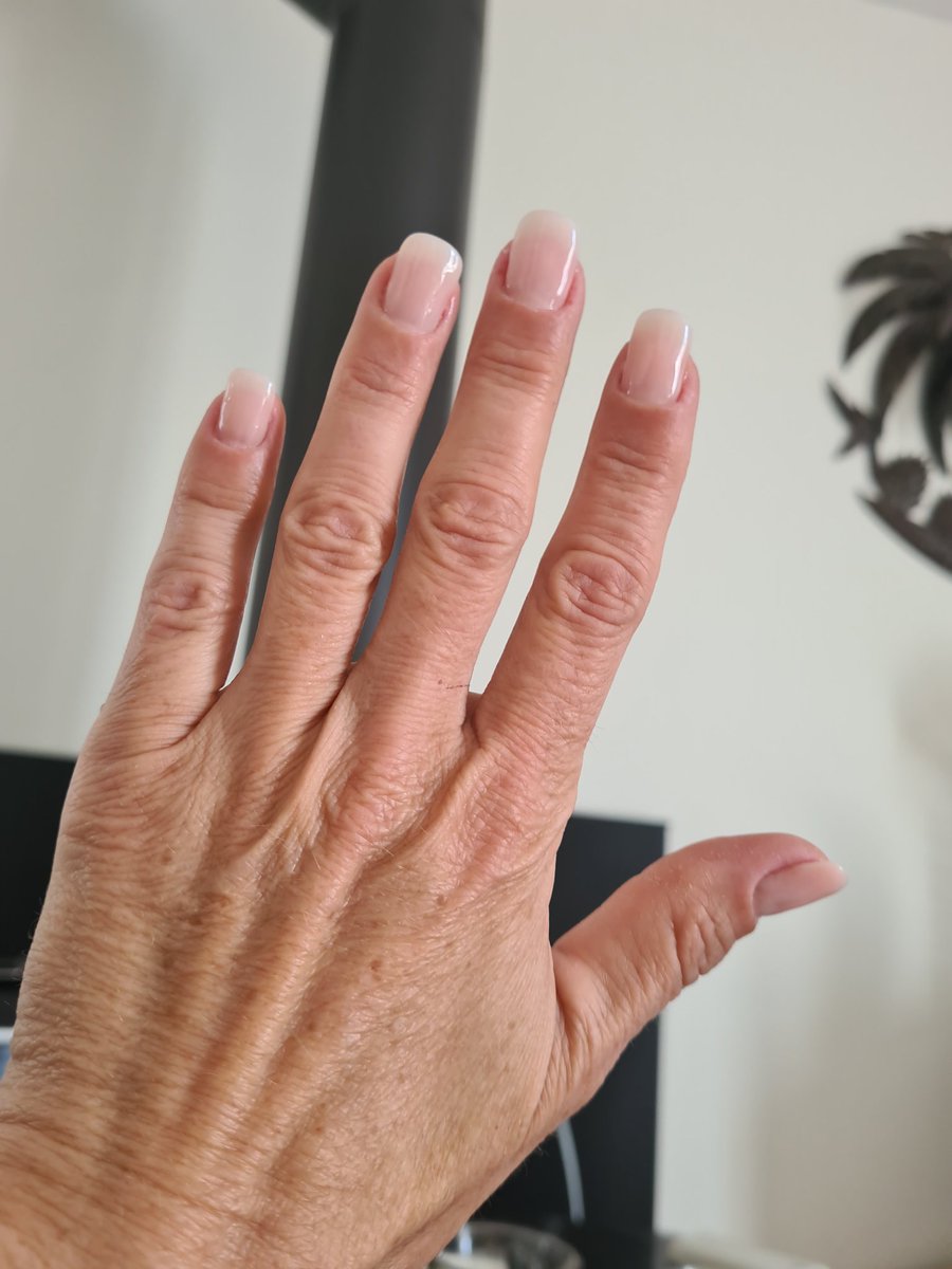 TheFrakNurse's tweet photo. Wow
10 ans que j'avais pas fait ça
Sur 24h carrément, suis KO
Vive les vacances et les ongles longs
#TeamIDE https://t.co/SF3yA4INtx