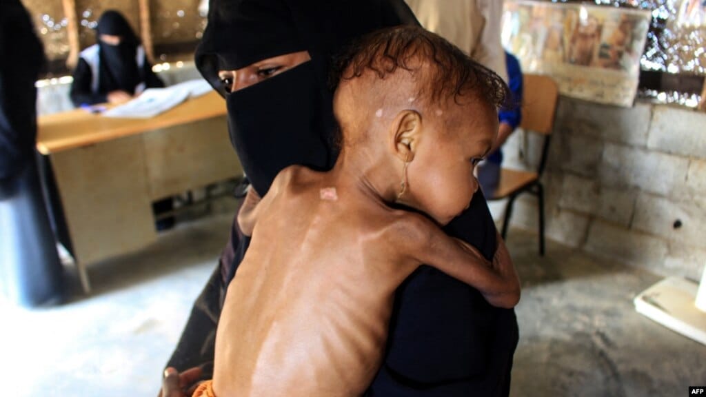 moraa_illah's tweet photo. Hunger is a battle we can win , hunger hurts and we will fight it to the end. # FightHunger https://t.co/aN1GZ4M2zG