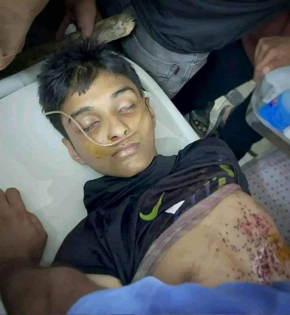 bd_fongrify's tweet photo. Sheikh Hasina not even sparing 17yr old Kid.

Shame on Bangladesh Government.

#StepDownHasina #SaveBangladeshiStudents #StudentsUnderAttack #DhakaUnversity https://t.co/WzkaMN52rD