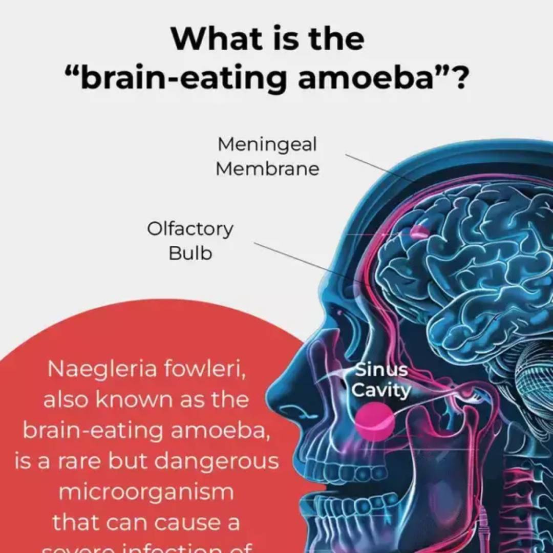 samplevisual's tweet image. Learn about Naegleria fowleri, the &quot;brain-eating amoeba. 
samplevisualization.com/understanding-…
#BrainEatingAmoeba #NaegleriaFowleri #HealthAwareness #BrainInfection #AmoebaInfection #PublicHealth #WaterSafety #RareDiseases #InfectionPrevention #HealthEducation #ParasiteAwareness