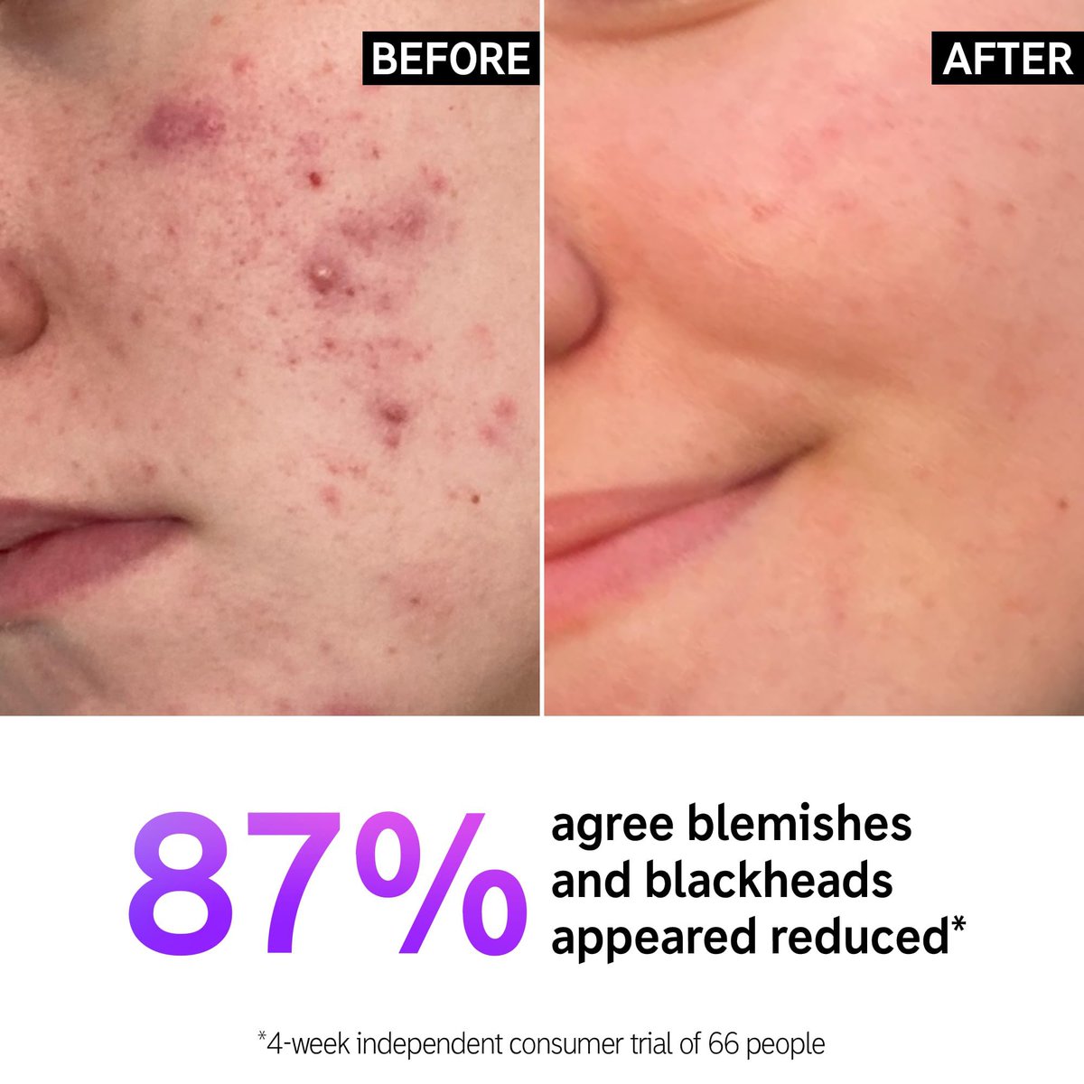 MNiceties's tweet photo. 🌟THE INKEY LIST SALICYLIC ACID CLEANSER
This non-drying, lightly foaming cleanser removes makeup &amp; dirt, while penetrating deep into pores to reduce blackheads &amp; breakouts.

🌟PRICE: 100k
🌟SIZE: 150ml
📱Call/ WhatsApp 0755232119 to order. 
✨FREE DELIVERY FOR ORDERS ABOVE 100k. https://t.co/PXuVWH7bWO