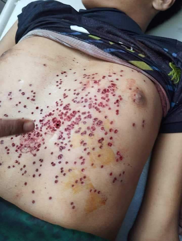 HaSan6484's tweet photo. @KabulFrontline All aye on Bangladesh.  
all kinds of telecommunications, mobile networks, internet, TV channels, radio  everything has been shutdown in Bangladesh. 
Bangladesh Army, police, RAB, BGB, Bangladesh chatro league and the ruling government, All together killing Bangladeshi students. https://t.co/xrUgorgwKR