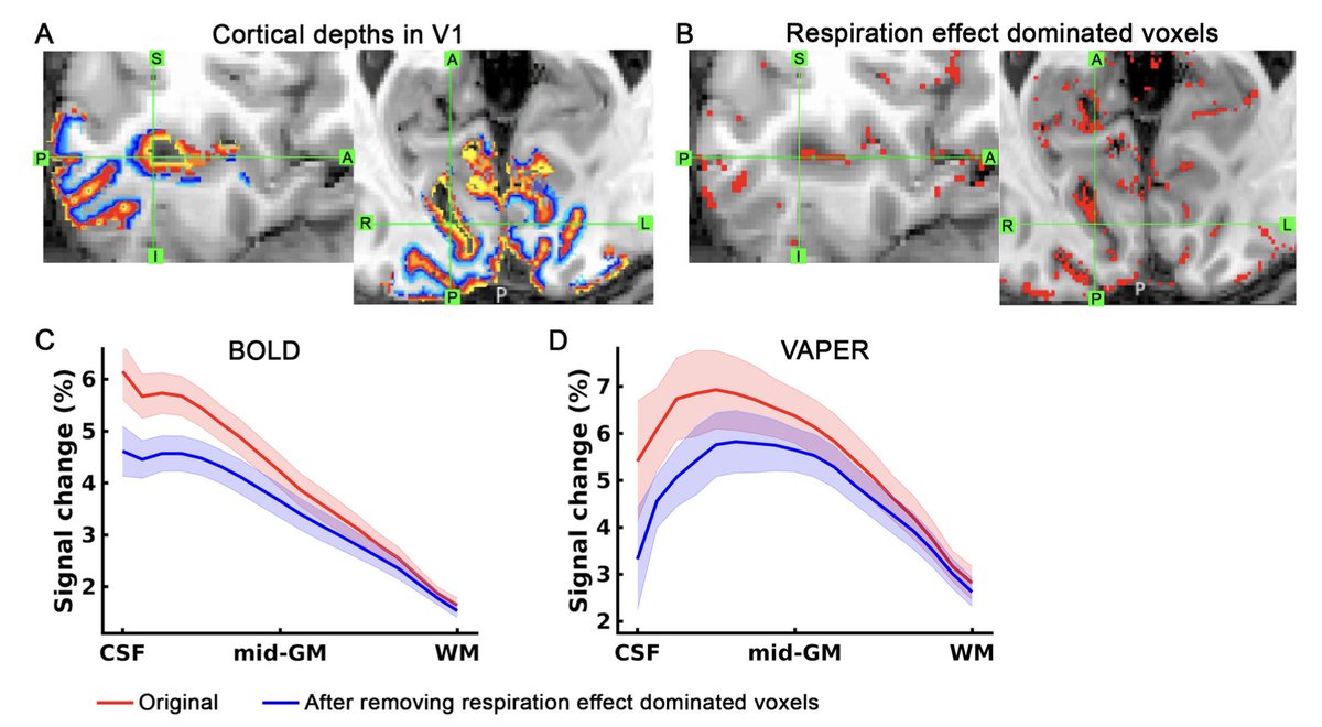 layerfMRI's tweet photo. New layer-fMRI paper proposes how to reduce vascular biases by means of using respiratory signals.
By Yuhui Chai (@mripku) et al.
https://t.co/3fJz9PNuIW https://t.co/uEnFDTSyY6