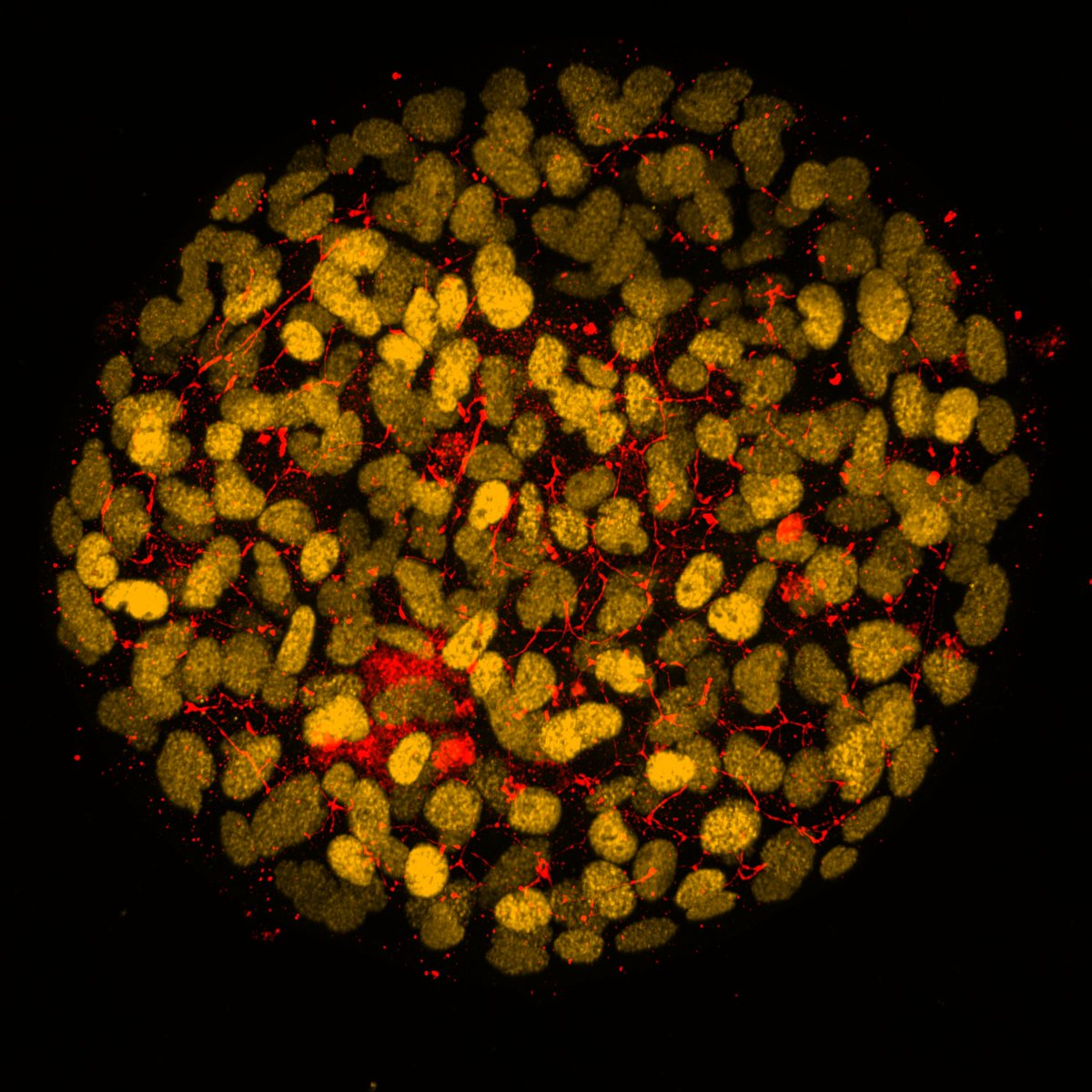 micahschott's tweet photo. Exciting day yesterday as our Andor #BC43 benchtop confocal microscope was installed! My favorite image so far is the human liver organoid we made from iPSCs. Thanks to @AndorTechnology @TANSTAAFL0713 @UNMC_Biochem and @NIGMS! HNF4a (Y), E-cadherin (R) https://t.co/N8hW29Wx6n