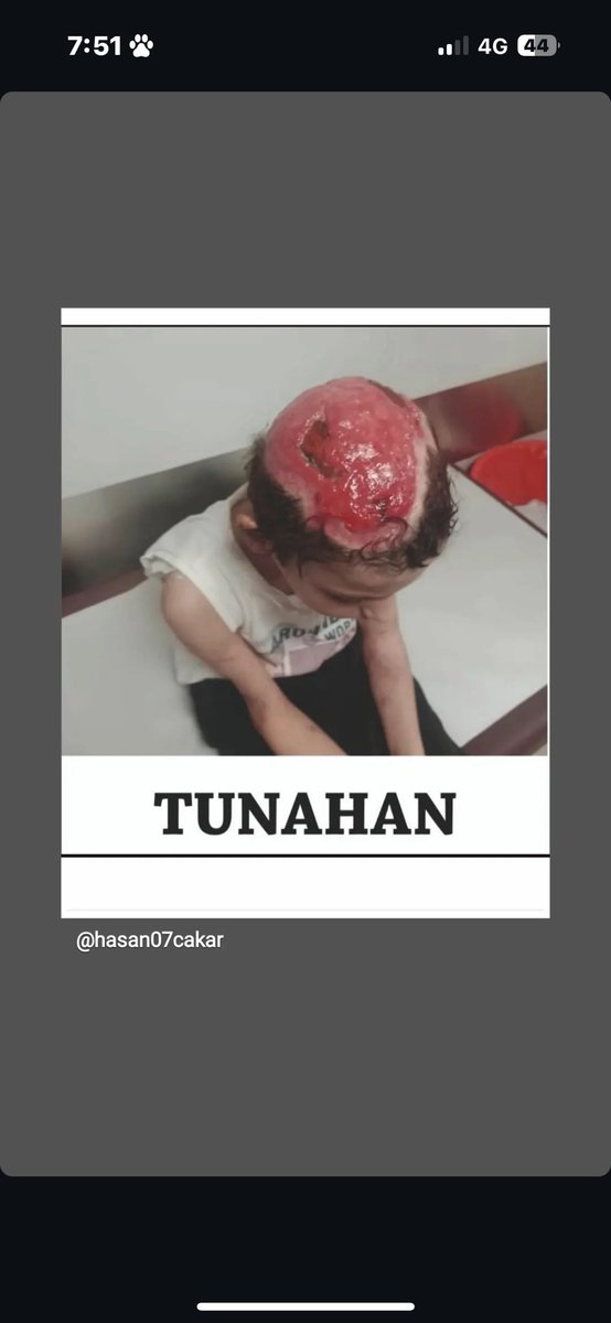 #Tunahan😔chpli vekillerin samimi olduklarını düşünmüyorum <a href="/veliagbaba/">Veli Ağbaba</a> nın bile #SokaktaBaşıBoşKöpekOlmaz #YasayaEvet