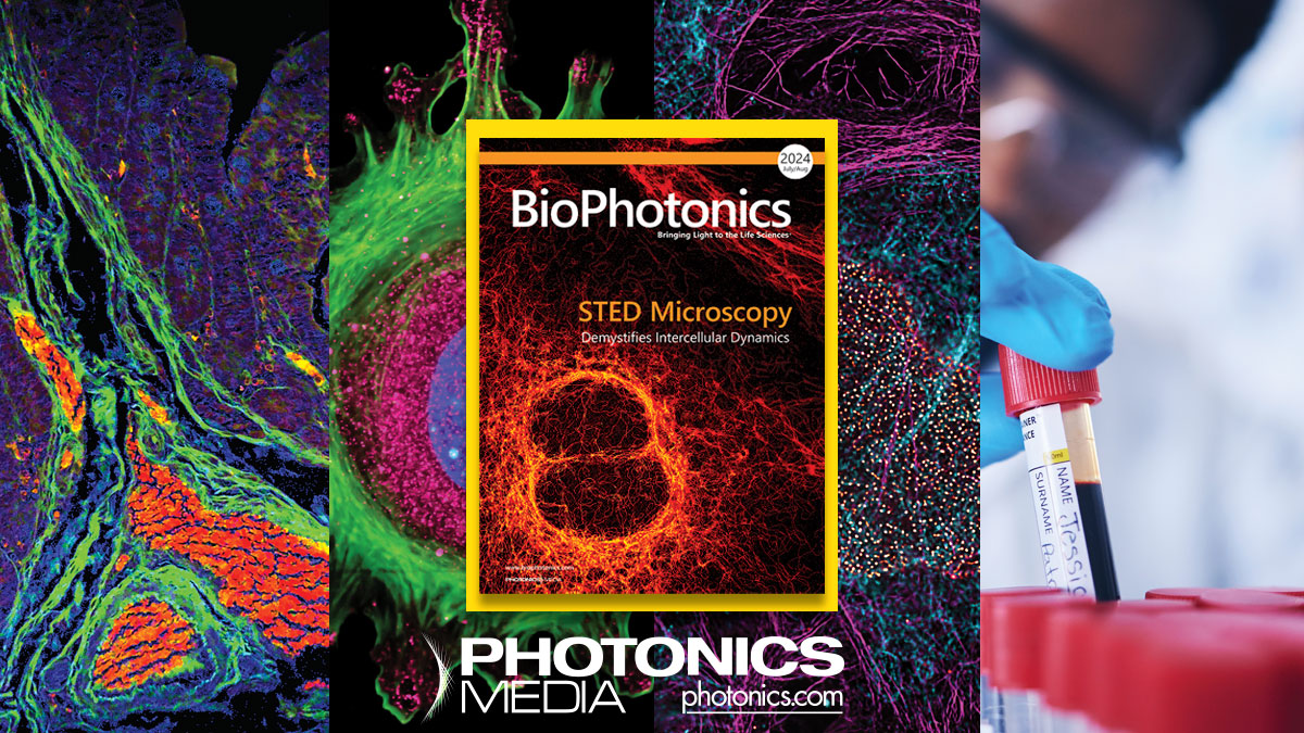 TheBioPhotonics's tweet photo. STED microscopy has been adapted to acquire spatial and temporal data, helping to unveil the mystery of intercellular communication.
 
Read about advancements in STED microscopy and more progress in #photonics in the July/Aug issue of #BioPhotonics at: https://t.co/7Z2qnRrRYY https://t.co/eC16h4TPj3