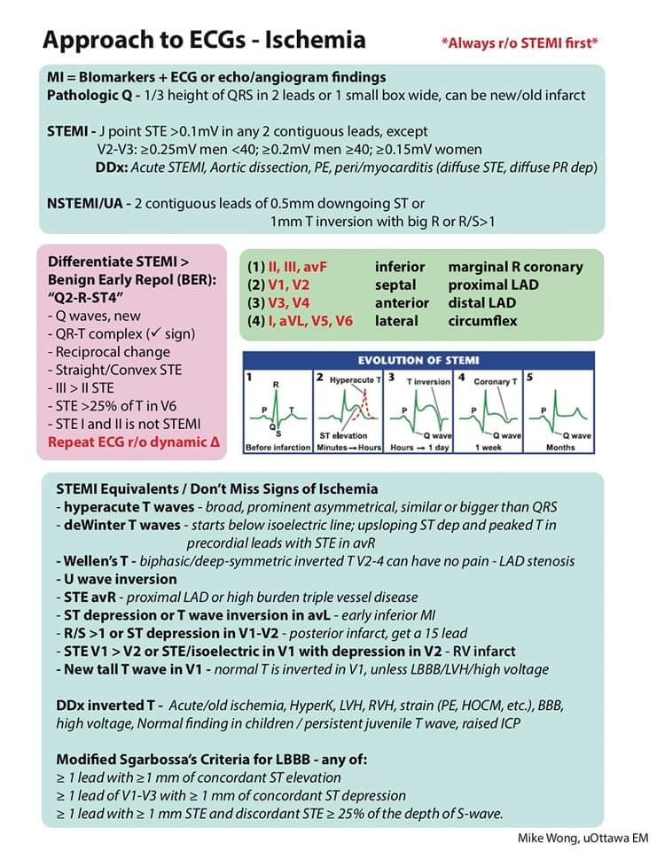 ZHeart11768530's tweet photo. 🔴Approach to ECGs - Ischemia

Dr. Michael Wong @mchlwng
#Ischemia #ECG #EKG #diagnosis #electrocardiogram #cardiology #STEMI #Equivalents #Interpretation #differential  #CardioEd #cardiology #MedEd #ECG #ekg #FOAMed #MedX #CardioTwitter #MedTwitter #medEd #CardioEd #medtwitter https://t.co/KUa5w96kDu