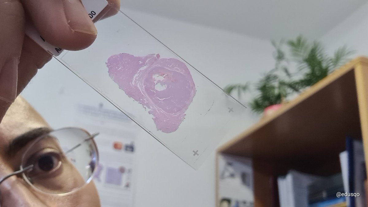 Eduardo Alcaraz, MD PhD tweet media