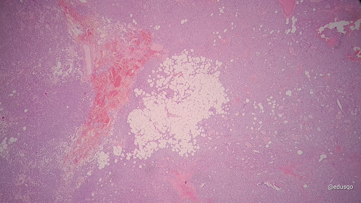 Eduardo Alcaraz, MD PhD tweet media