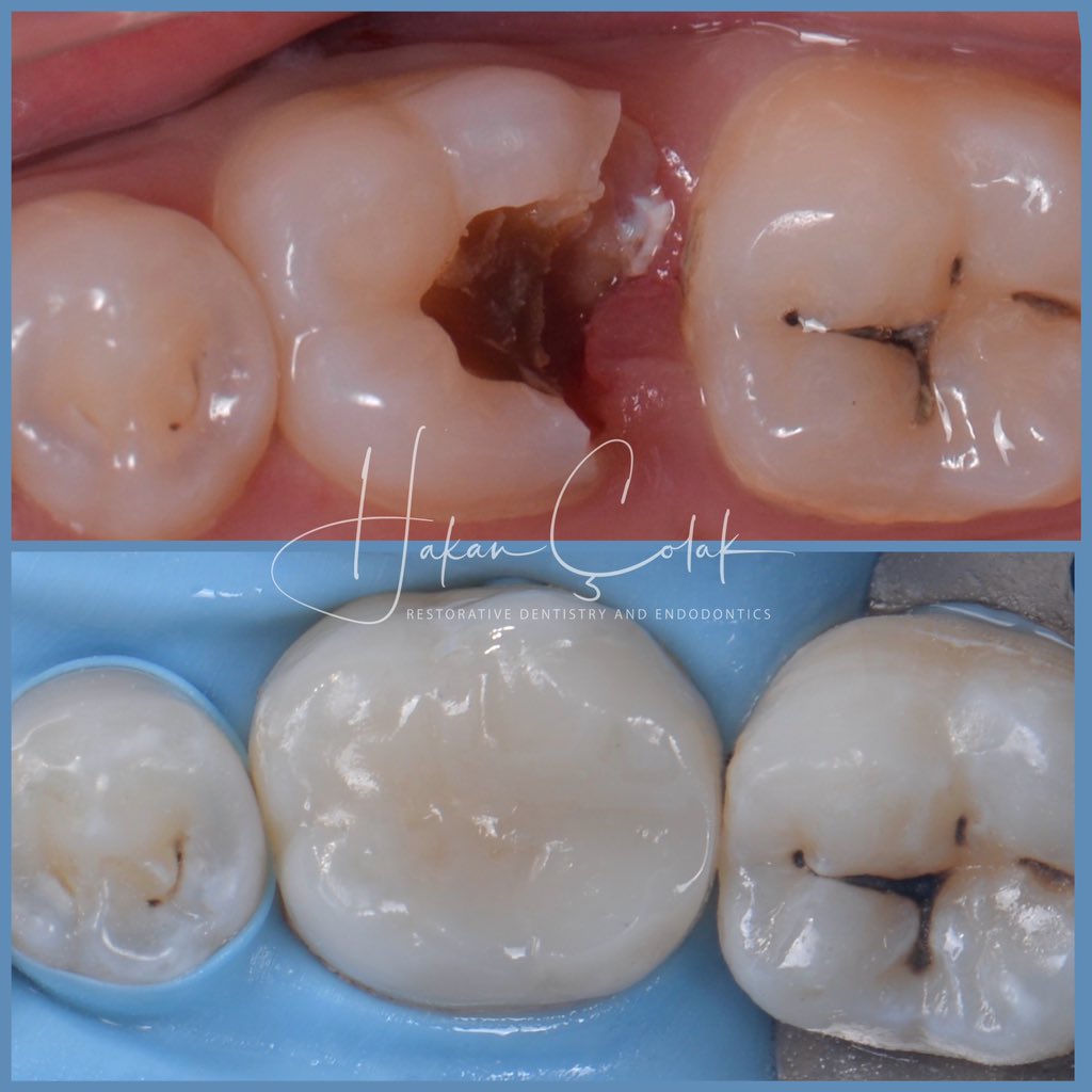 Hakan Çolak (@hakancolakdds) on Twitter photo 