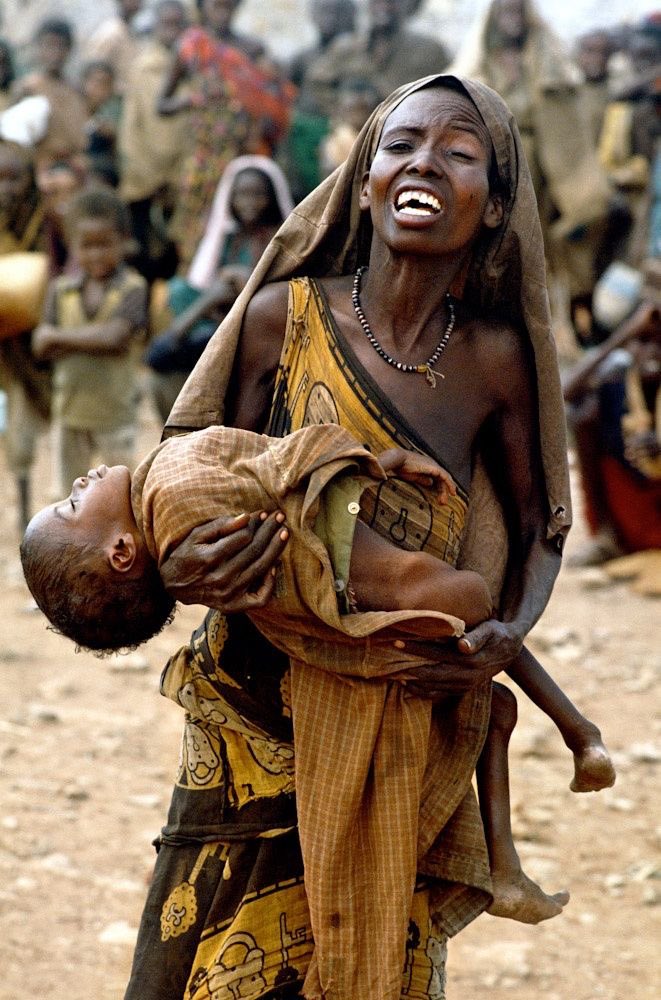 nyaddibo's tweet photo. Malnutrition is a global issue, but together we can create change. Donate or volunteer to support our initiatives. #FightHunger https://t.co/jHsEMO5MNf